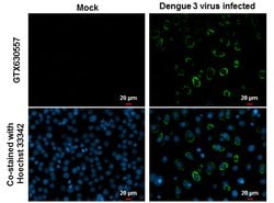 Invitrogen Dengue Virus Type 2 NS1 Monoclonal Antibody (GT1061) 100 &mu;L | Buy Online | Invitrogen&trade; | Fisher Scientific