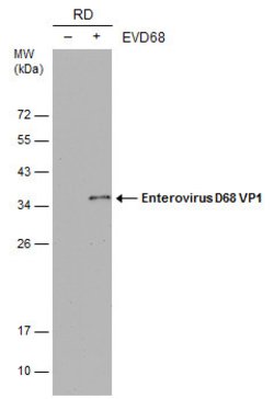 Enterovirus D68 VP1 Monoclonal Antibody (GT162), Invitrogen 100 &mu;L;