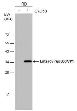 Invitrogen Enterovirus D68 VP1 Monoclonal Antibody (GT1843) 100 &mu;L;
