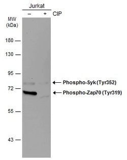 Invitrogen Phospho-Zap-70 (Tyr319, Tyr352) Monoclonal Antibody (GT364)