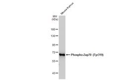 Invitrogen Phospho-Zap-70 (Tyr319, Tyr352) Monoclonal Antibody (GT364)