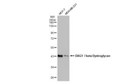 Invitrogen beta Dystroglycan Monoclonal Antibody (GT9112) 100 &mu;L; Unconjugated:Antibodies,