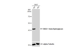 Invitrogen beta Dystroglycan Monoclonal Antibody (GT835) 100 &mu;L | Buy Online | Invitrogen&trade; | Fisher Scientific