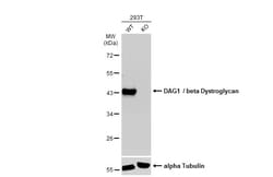 Invitrogen beta Dystroglycan Monoclonal Antibody (GT2812) 100 &mu;L; Unconjugated:Antibodies,