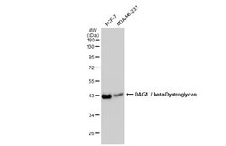 Invitrogen beta Dystroglycan Monoclonal Antibody (GT2812) 100 &mu;L; Unconjugated:Antibodies,