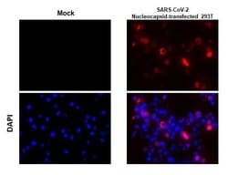 Invitrogen SARS-CoV/SARS-CoV-2 Nucleocapsid Monoclonal Antibody (6H3) 100 &mu;L | Buy Online | Invitrogen&trade; | Fisher Scientific