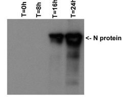 Invitrogen SARS-CoV/SARS-CoV-2 Nucleocapsid Monoclonal Antibody (6H3) 100 &mu;L | Buy Online | Invitrogen&trade; | Fisher Scientific