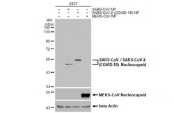Invitrogen SARS-CoV/SARS-CoV-2 Nucleocapsid Monoclonal Antibody (6H3) 100 &mu;L | Buy Online | Invitrogen&trade; | Fisher Scientific