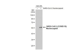 Invitrogen SARS-CoV/SARS-CoV-2 Nucleocapsid Monoclonal Antibody (6H3) 100 &mu;L | Buy Online | Invitrogen&trade; | Fisher Scientific