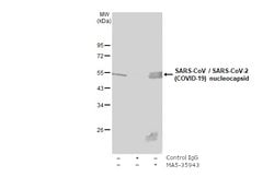 Invitrogen SARS-CoV/SARS-CoV-2 Nucleocapsid Monoclonal Antibody (6H3) 100 &mu;L | Buy Online | Invitrogen&trade; | Fisher Scientific