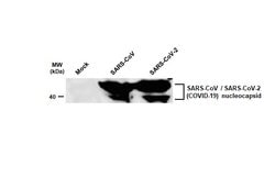 Invitrogen SARS-CoV/SARS-CoV-2 Nucleocapsid Monoclonal Antibody (6H3) 100 &mu;L | Buy Online | Invitrogen&trade; | Fisher Scientific