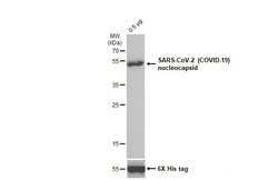 Invitrogen SARS-CoV/SARS-CoV-2 Nucleocapsid Monoclonal Antibody (6H3) 100 &mu;L | Buy Online | Invitrogen&trade; | Fisher Scientific