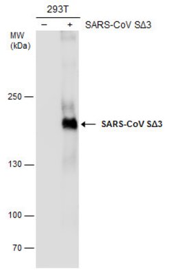 Invitrogen SARS-CoV Spike Protein (SDelta3) Monoclonal Antibody (7G12)