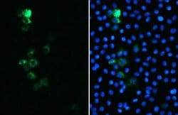 Invitrogen SARS/SARS-CoV-2 Spike Protein S2 Monoclonal Antibody (1A9) 100