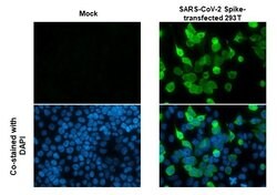 Invitrogen SARS/SARS-CoV-2 Spike Protein S2 Monoclonal Antibody (1A9) 100