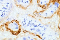 Invitrogen SARS/SARS-CoV-2 Spike Protein S2 Monoclonal Antibody (1A9) 100
