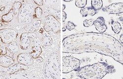Invitrogen SARS/SARS-CoV-2 Spike Protein S2 Monoclonal Antibody (1A9) 100
