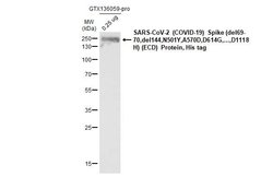 Invitrogen SARS/SARS-CoV-2 Spike Protein S2 Monoclonal Antibody (1A9) 100