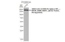 Invitrogen SARS/SARS-CoV-2 Spike Protein S2 Monoclonal Antibody (1A9) 100