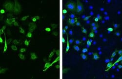 Invitrogen SARS/SARS-CoV-2 Spike Protein S2 Monoclonal Antibody (1A9) 100