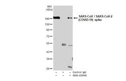 Invitrogen SARS/SARS-CoV-2 Spike Protein S2 Monoclonal Antibody (1A9) 100