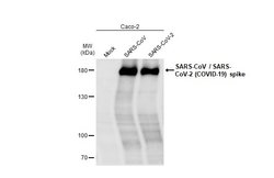 Invitrogen SARS/SARS-CoV-2 Spike Protein S2 Monoclonal Antibody (1A9) 100