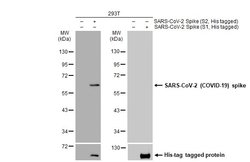 Invitrogen SARS/SARS-CoV-2 Spike Protein S2 Monoclonal Antibody (1A9) 100