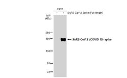 Invitrogen SARS/SARS-CoV-2 Spike Protein S2 Monoclonal Antibody (1A9) 100