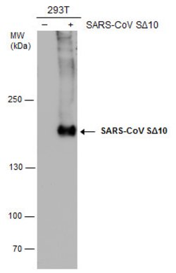 Invitrogen SARS/SARS-CoV-2 Spike Protein S2 Monoclonal Antibody (1A9) 100