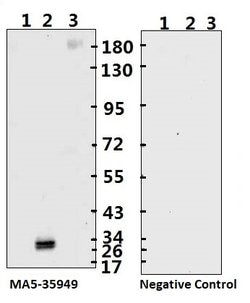 Invitrogen SARS-CoV-2 Spike Protein (S1/S2) Monoclonal Antibody (bcb02)