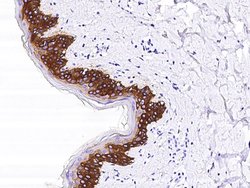 Invitrogen Cytokeratin 14 Recombinant Rabbit Monoclonal Antibody (101)