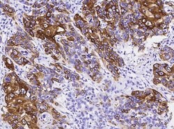 Invitrogen Cytokeratin 14 Recombinant Rabbit Monoclonal Antibody (101)
