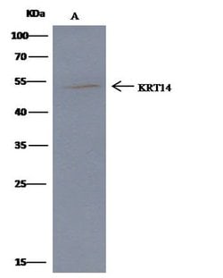 Invitrogen Cytokeratin 14 Recombinant Rabbit Monoclonal Antibody (101)