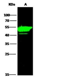 Invitrogen Cytokeratin 14 Recombinant Rabbit Monoclonal Antibody (101)
