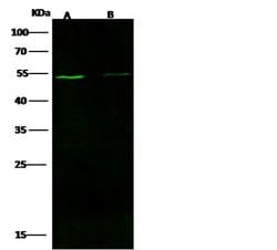 Invitrogen Chromogranin A Recombinant Rabbit Monoclonal Antibody (039)
