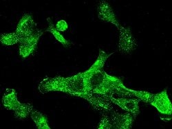 Invitrogen Cytokeratin 5 Recombinant Rabbit Monoclonal Antibody (176) 100