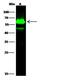 Invitrogen Cytokeratin 5 Recombinant Rabbit Monoclonal Antibody (176) 100