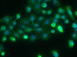 Invitrogen SPARCL1 Monoclonal Antibody (6D1D6G5) 100 &mu;L | Buy Online | Invitrogen&trade; | Fisher Scientific