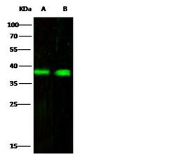 Invitrogen CD32b Recombinant Rabbit Monoclonal Antibody (110) 100 &mu;L;