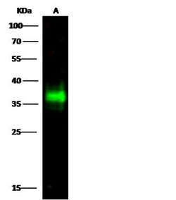 Invitrogen CD7 Recombinant Rabbit Monoclonal Antibody (307) 100 &mu;L | Buy Online | Invitrogen&trade; | Fisher Scientific