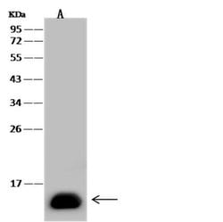 Invitrogen FABP1 Monoclonal Antibody (06) 100 &mu;L | Buy Online | Invitrogen&trade; | Fisher Scientific