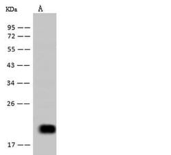 Invitrogen IL-5 Recombinant Rabbit Monoclonal Antibody (225) 100 &mu;L;