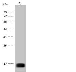 Invitrogen West Nile Virus Envelope (Domain III) (lineage 1, strain NY99)