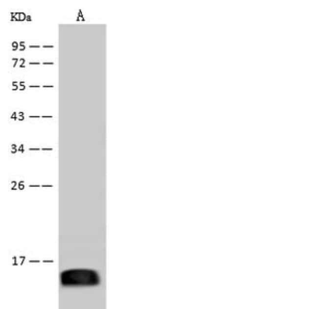 Zika Virus Envelope (Domain III) (strain Zika SPH2015) Recombinant ...