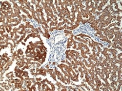 Invitrogen CPS1 Recombinant Rabbit Monoclonal Antibody (RM395) 100 &mu;L;