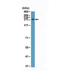 Invitrogen CPS1 Recombinant Rabbit Monoclonal Antibody (RM395) 100 &mu;L;