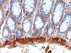 Invitrogen Caldesmon Recombinant Rabbit Monoclonal Antibody (RM396) 100