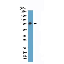 Invitrogen Caldesmon Recombinant Rabbit Monoclonal Antibody (RM396) 100