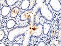 Invitrogen Helicobacter pylori Recombinant Rabbit Monoclonal Antibody (RM400)