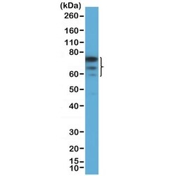 Invitrogen FOXP1 Recombinant Rabbit Monoclonal Antibody (RM402) 100 &mu;L;